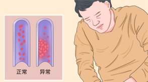 VTE的危害您了解嗎？