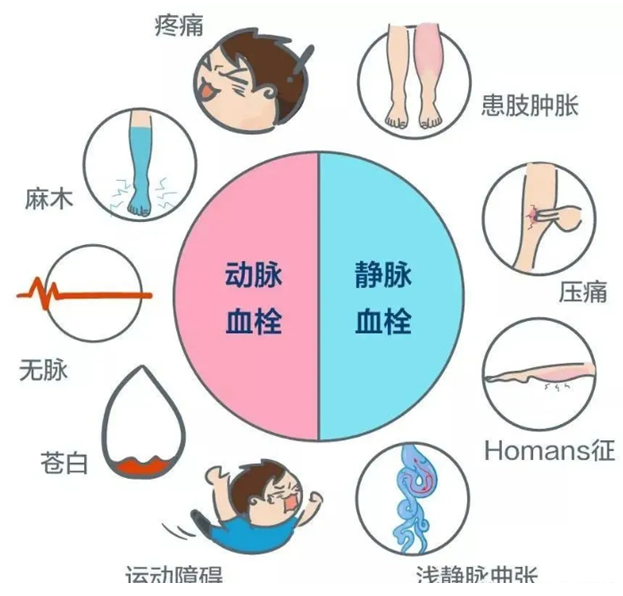 2022世界血栓日：就醫(yī)有新路，血栓找介入