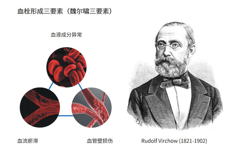 世界血栓日 | 拴不住，動(dòng)起來(lái)