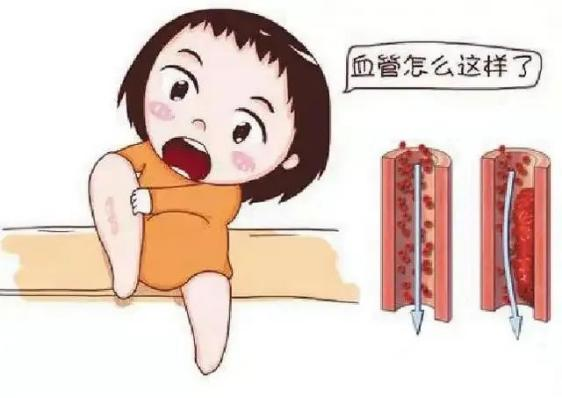 腫瘤不容忽視的第二號殺手—VTE，該如何防治？