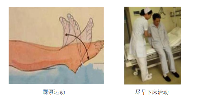 圍術(shù)期患者VTE的預(yù)防，只知道抗凝可不行