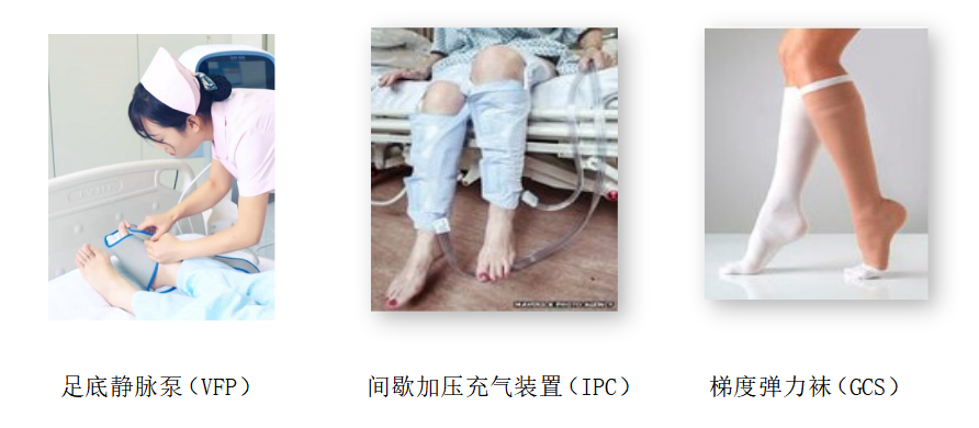 圍術(shù)期患者VTE的預(yù)防，只知道抗凝可不行
