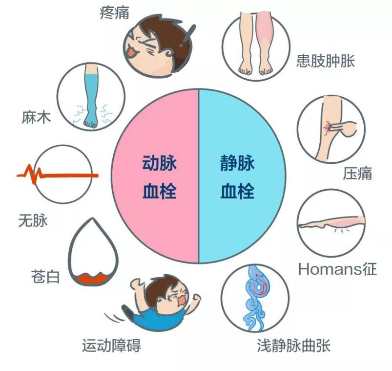 深靜脈血栓能致命，防治“大法”要了解！